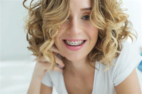 tits braces|Dental Braces and Retainers: Types, Care, What to Expect